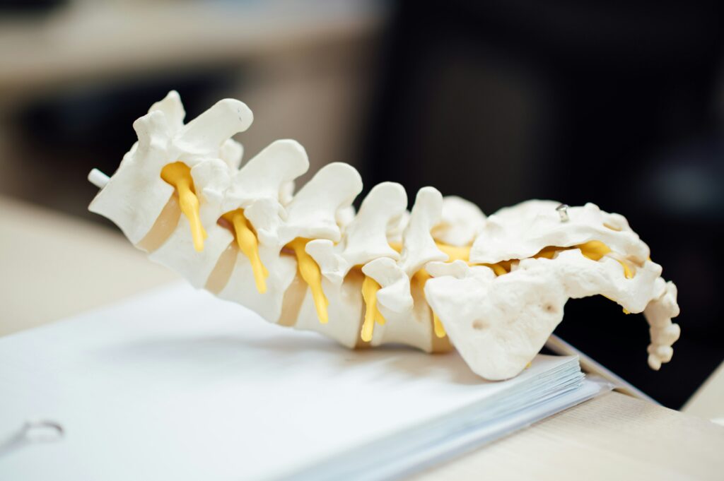 3D model of a lumbar and sacral spine