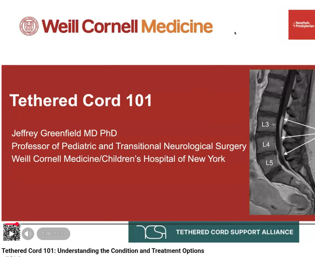 Tethered Cord 101: Understanding the Condition and Treatment Options